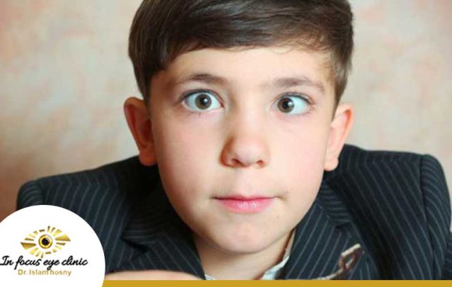 علاج الحول عند الأطفال 4 علاج الحول عند الأطفال
