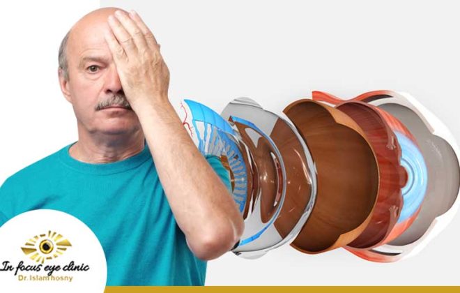 اعراض-انفصال-الشبكية