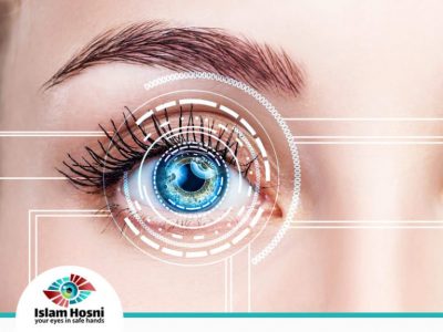 عملية الفيمتو سمايل