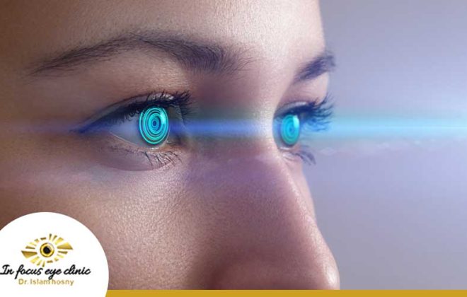 عملية-الترا-ليزك-للعيون