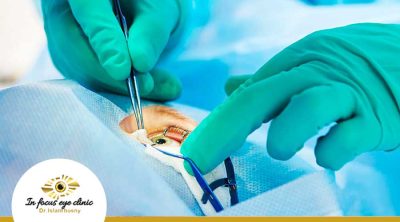 عملية-المياة-البيضاء-وزرع-عدسة