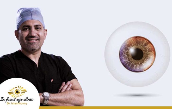 افضل-دكتور-قرنية-في-مصر