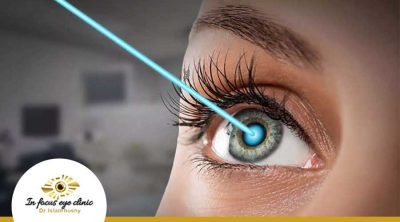 تجربتي-مع-الفيمتو-سمايل