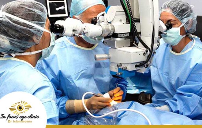 تكلفة عملية انفصال الشبكية في مصر