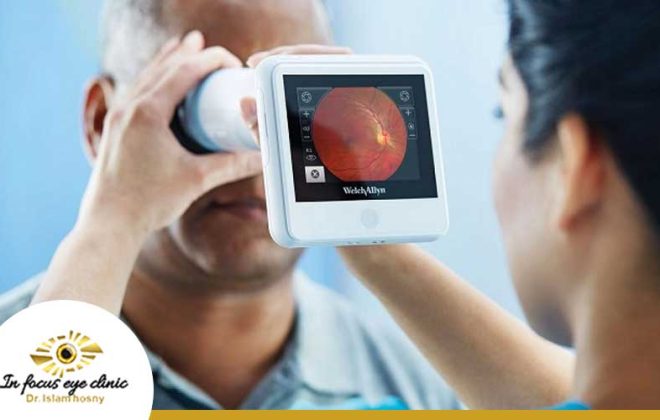 علاج-شبكية-العين-لمرضى-السكري
