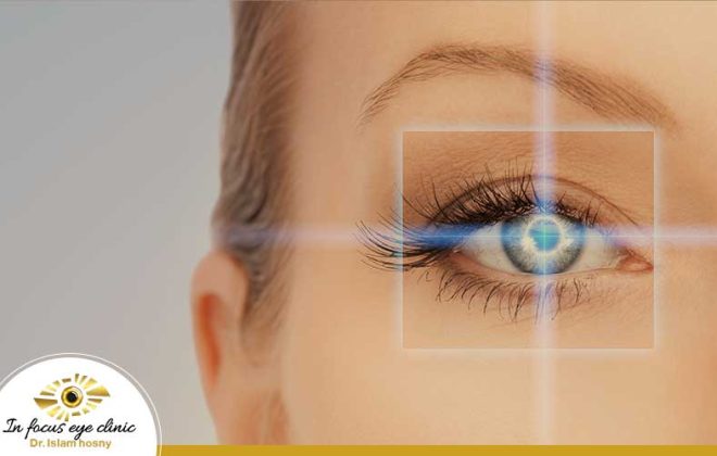 متى يتحسن النظر بعد عملية تثبيت القرنية